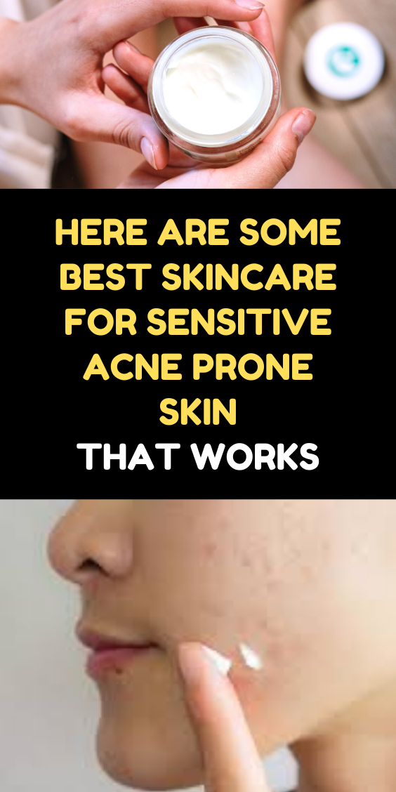 Here Are Some Best Skincare For Sensitive Acne Prone Skin That Works