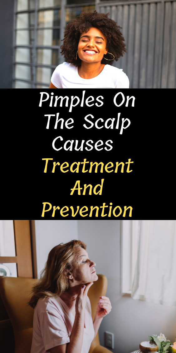 pimples-on-the-scalp