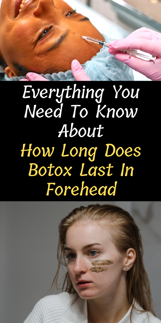 How Long Does Botox Last In Forehead