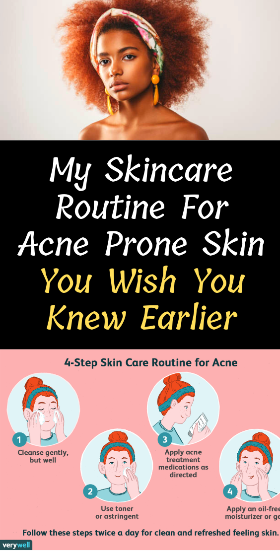 my-skincare-routine-for-acne-prone-skin
