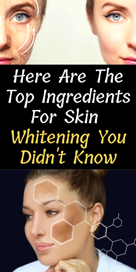 top-ingredients-for-skin-whitening