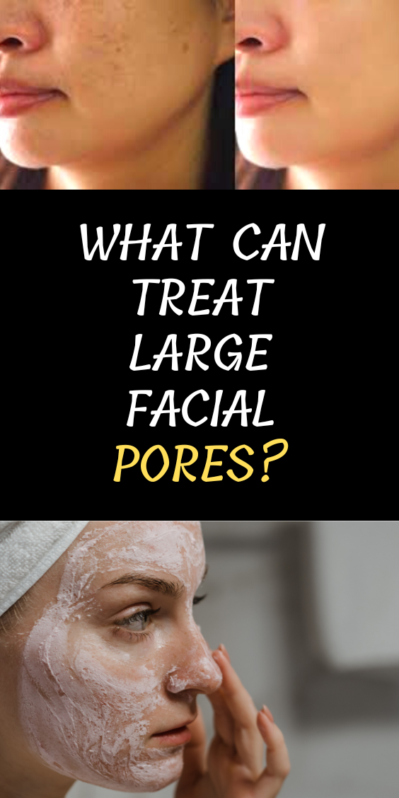 large-facial-pores